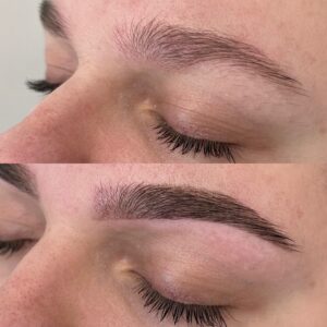 Eyebrow leicester